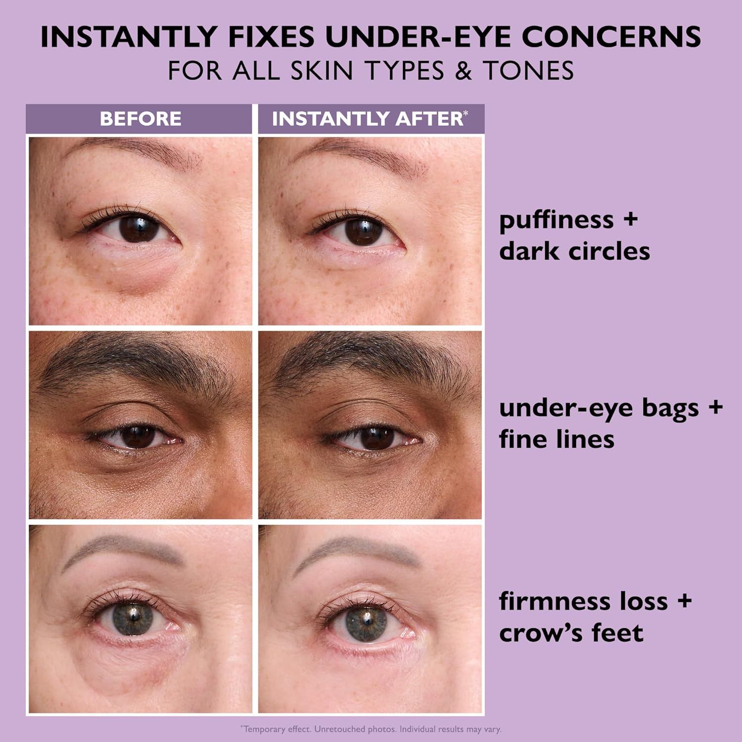 Lennu Instant Eye Lift – Direct Strakkere & Gladdere Oogopslag