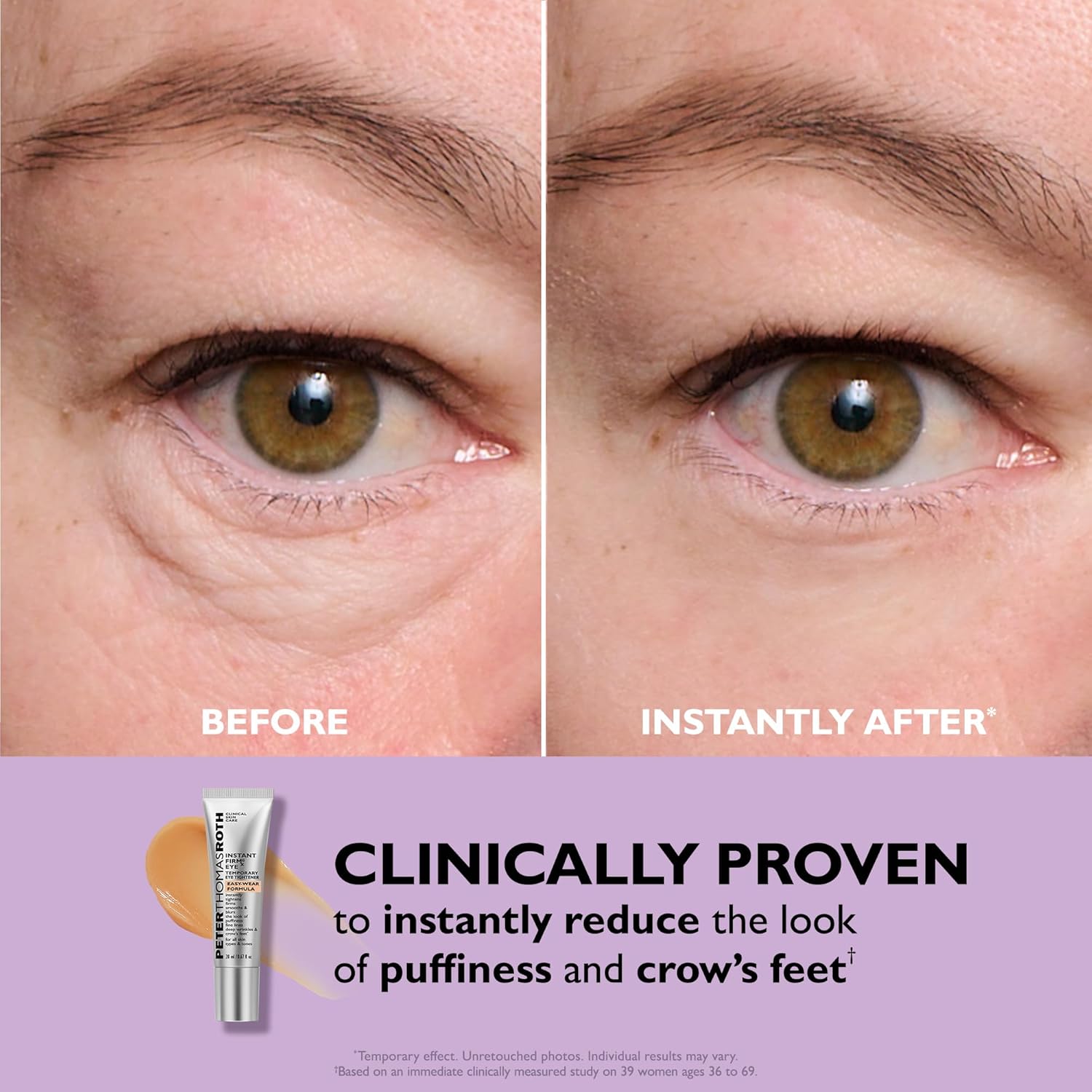 Lennu Instant Eye Lift – Direct Strakkere & Gladdere Oogopslag